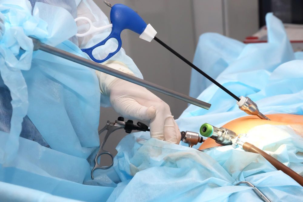 Laparoscopic-Hernia-Surgery